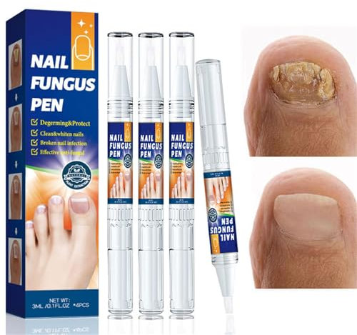 4PCS Fungal Nail Treatment Pen,Nail Fungus Treatment for Toenails Extra Strong,Toe Nail Fungal Nail Repair Essence,Antifungal Nail Repair Fast Results