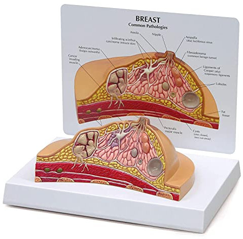 Pathologisches Brustanatomisches Modell Brustquerschnittsmodell Anatomie Anatomie der Brust mit gemeinsamen Pathologien für Lehrmittel Geburtshilfe und GYN