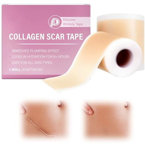 Silikon Narbenblätter, 4cm x 150cm Wasserfest Silikonpflaster für Narben, Wiederverwendbare Silicone Scar Tape für C Sektion, Operationen, Verbrennungen, Akne Hautfreundlich, Atmungsaktiv (1Pcs)