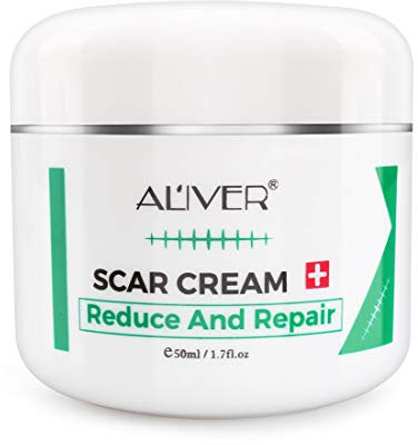Mcukv Crema Avanzata Scar cream Trattamento Rimuovere Cicatrici Chirurgiche, Acne Veloce Efficace Su Smagliature Cheloide, Lesioni, Ustioni, Cicatrici vecchie e nuove,50ml