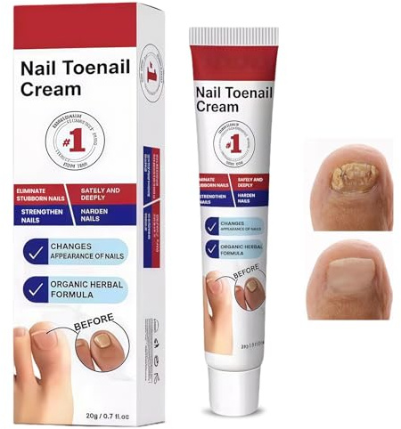 20g Crème de Soin des Ongles, Nail Care Nourishing Cream, Soin Ongles Des Pieds, Nourrissant Réparation Renfort ongles, Pour ongles Abîmés, Décolorés, Adapté Hommes et Femmes
