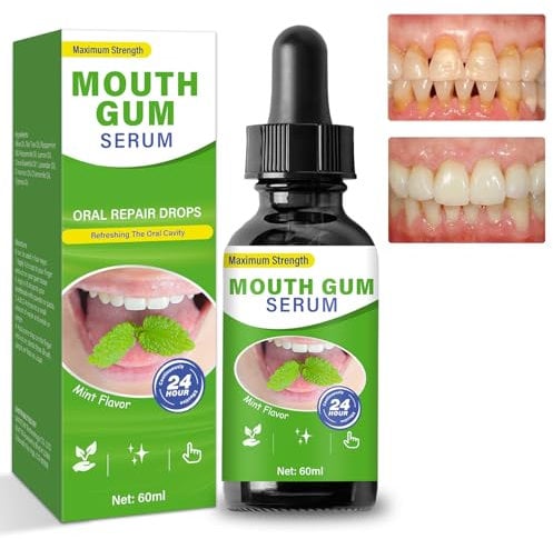 Gum Repair Drops, Effektive Tropfen zur Reparatur von zurück tretenden Zahnfleischen, Entzündungsreduzierung und Frische im Mund