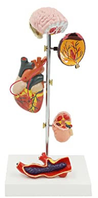 UIGJIOG Pathologisches Modell des Menschlichen Bluthochdrucks 5 Teile Gehirn Auge Herz Niere Blutgefäß PVC Lebensgroßes Menschliches Nieren-Organ-Anatomie-Modell Pädagogisch 16,5 * 12 * 36 cm