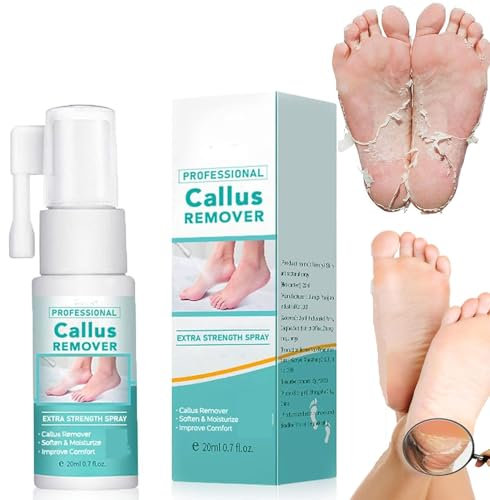 Spray professionale per la rimozione dei calli extra forte, spray per la rimozione dei calli dei piedi, spray per rimuovere calli e talloni, olio spray per rimuovere la pelle morta e i calli sui piedi