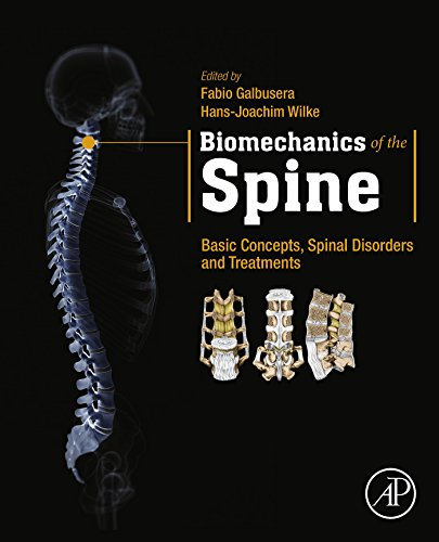 Biomechanics of the Spine: Basic Concepts, Spinal Disorders and Treatments (English Edition)