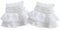 Yurosiay Damen Spitze Manschette 1 Paar Stretch Spitzenmanschette Kurz Rüschen Handgelenk Manschette Spitze Lolita Falsche Ärmel Elegant Chiffon Armstulpen Spitze Handgelenk Stulpen Weiße