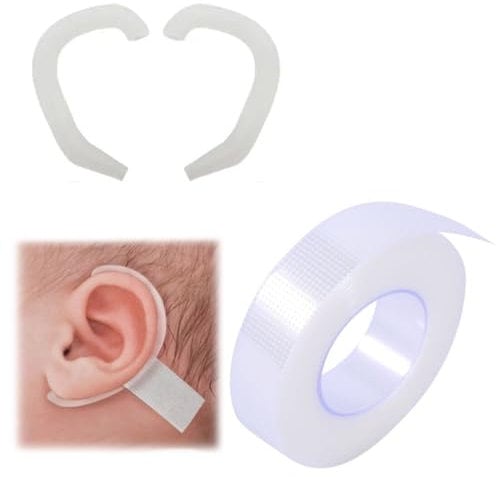 IKOPFLN Juego de Parches Orejeros para Niños,Corrector de Orejas Protuberantes,con 1 Rollo de Parche Corrector de Orejas de Gel de Silicona(1.25x900CM) - Estilos B