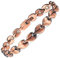 Knöchelstütze Gesundheit Anti Müdigkeit Magnetfeldtherapie Kupfer Magnetische Fußkettchen Fußkettchen für Frauen Schmerzlinderung bei Arthritis (Fußkettchen/Großes Armband (24cm/9mm)