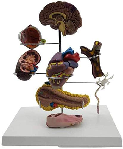 DYTAH Modell Pathologischer Diabetes, 8 Teile des Anatomischen Modells Der Diabetischen Organe (Augapfel, Herz, Leber, Blutgefäße