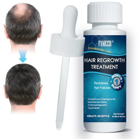 60ML Sérum Crecimiento y Anticaída del Cabello, Reduce la Pérdida de Cabello, Siero Anticaduta per Uomo e Donna, Unisex para Hombres y Mujeres