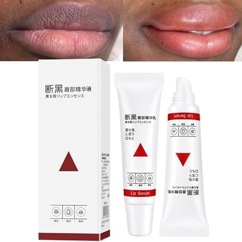Lip Lightening For Dark Lips, Lips Pink Fresh Lightening Bleaching Cream, Lip Lightener for Smokers Lips Lip Lightening balm for Men and Women 15ml, Whitening Moisturizer Essence (1pcs)