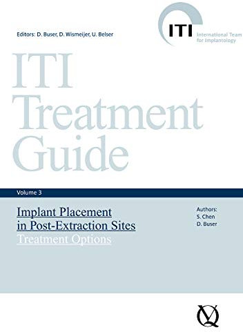 Implant Placement in Post-Extraction Sites: Treatment Options (ITI Treatment Guide Series Book 3) (English Edition)