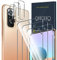 QHOHQ 3 Stück Schutzfolie für Xiaomi Redmi Note 10 Pro/Note 10 Pro Max mit 3 Stück Kamera Schutzfolie, Panzer folie Membran, 9H Härte - HD - Anti-Kratz - Blasenfrei - Einfach Installieren