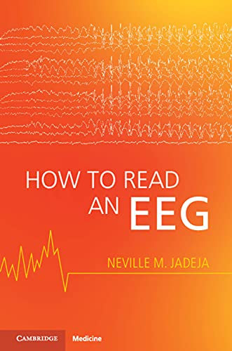 How to Read an EEG (English Edition)