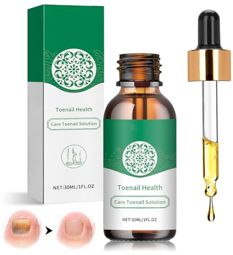 nailgeler 30ml Fußnägel Behandlung, Schnell Wirkendes Nagelbehandlung, Nagelpflege, Nail Care, Ohne Feilen