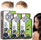 Ginger Plant Extract Anti-Hair Loss Hair Shampoo, Ginger Plant Anti-Hair Loss Hair Shampoo, Anti-Hair Loss, Promotes Hair Growth (2box)