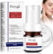 Freckle Removing Essence,Spot Remover for Face,Niacinamide Serum,40 ml,Fleckenentferner für Gesicht,Gesichtsserum für Alle Hauttypen