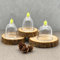 Sifa Mini Starter Schröpfen Set, 260x Schröpfgläser, 1x Derby Klingen, 1x Pumpe, Cupping Set, Hijama Set, Hacamat Seti,