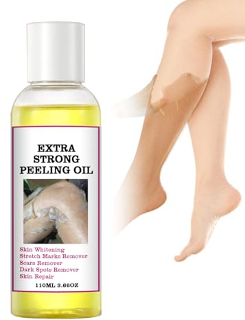 Extra Strong Gelbes Peeling Öl, 110ml Peeling-Öl Für Dunkle Haut Natural Spots Whitening Yellow Peeling Oil, Exfolierende Peeling Lösung Für Den Körper Aufhellende Hornhaut,Ellbogen,Knie,Finger