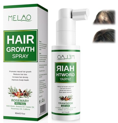 60ml Haarserum gegen Haarausfall,Männer Lösung,Haarpflegeserum Haar Flüssigkeit,Für dünner werdendes Haar, Fördern Sie starkes und dichtes haar