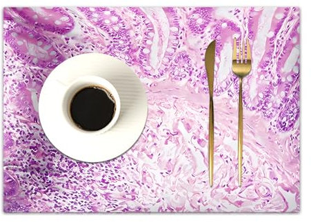 DASNK 4er Set Platzsets 30x45cmRutschfest Abwaschbar Tischmatten PVC Abgrifffeste Hitzebeständig Tischsets,Platz-Matten für küche,Mikroskopische Ansicht eines Ductus-Zell-Karzinoms, Adenokarzinom aus