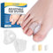 2 Stück Zehenstrecker Silikon,Zehentrenner Wiederverwendbar,Hallux Valgus Korrektor Atmungsaktiv,Toe Separator Transparente,Hammerzehen,Zehenabstandshalter für überlappend Zehen, Schmerzlinderung