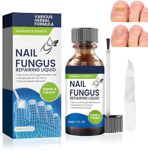 Fungal Nail Treatment — Toenail Fungus Treatment For Thick Discolored Nails, Fungal Toenail Treatment Brush On Liquid, 30Ml Daily Nail Care, Precision Brush Smooth Looking Finish