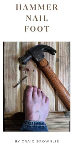 Hammer Nail Foot: 1 (Little Book of Pain)