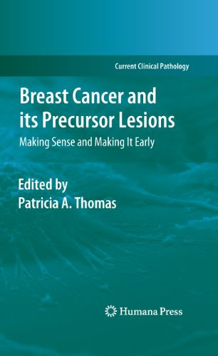 Breast Cancer and its Precursor Lesions: Making Sense and Making It Early (Current Clinical Pathology) (English Edition)