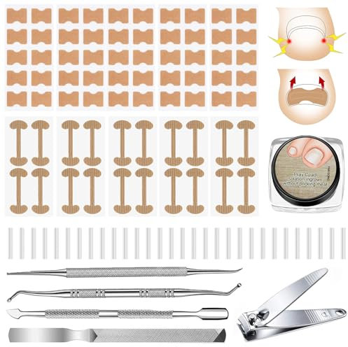 Eingewachsene Zehennägel Set, 105PCS Fusspflege Set mit Zehennagelkorrektur Patch/Schmerzfreie Zehennagelglättungsstreifen/Nagelzange/Zehennagel Feile/Nagelschieber/Heber für Eingewachsene Fußnägel