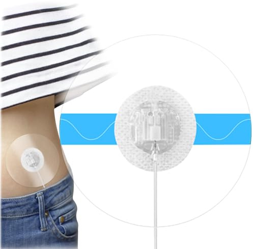 QaZanteiar 40 Stück Insulinpumpe Pflaster, Transparente und Wasserfeste Katheter Pflaster, Hypoallergen für Medtronic Insulinpumpen und CGM zum Schwimmen und Baden Geeignet, 14 Tage Klebekraft