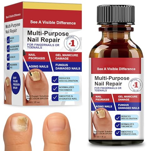 30ml Nagelpflege Flüssigkeit,Nagelaufbauserum Nail Repair Einfache Anwendung,Nailaufbauserum Hilft nägel widerstandsfähiger zu machen,Für schöneres und gepflegteres nagelbild