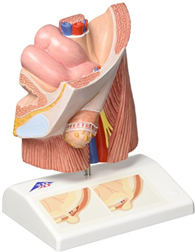 3B Scientific Menschliche Anatomie - Leistenbruchmodell + kostenlose Anatomie App - 3B Smart Anatomy