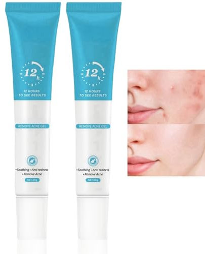 2PCS Acne Spot Treatment Gel, Anti Acne Face Cream, Blackheads Treatment