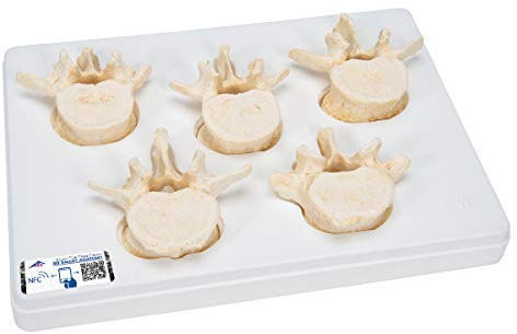 3B Scientific Menschliche Anatomie - Set mit 5 Lendenwirbeln + kostenlose Anatomie App - 3B Smart Anatomy