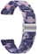 ibasenice Harz Uhr Band Dekorative Uhr Strap Ersatz Mode Harz Uhr Band Armband Kompatibel mit/Lite Schwarz Rosa