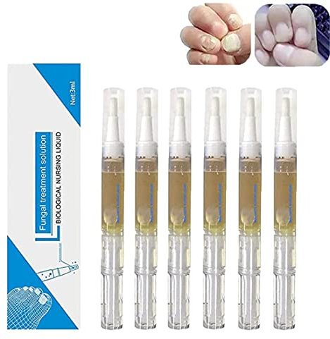 Okita Toenail Fungus Pen,Anti Toenail Fungus Pen,Nail Repair Pens For Broken,Restoring Healthy Strong Nails,Discolored Nails,Restoring Healthy Strong Nails (6PCS)