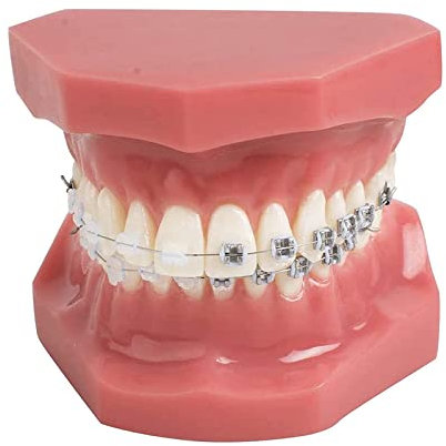 Modelo Dental Infantil, Modelo De Ortodoncia, Modelo De Ortodoncia con Cadena De Alambre Metálico, Modelo De Enseñanza De Demostración Dental para La Enseñanza En La Escuela De Estomatología