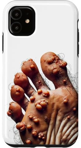 iPhone 11 Funny Ugly Cringe Phone Case