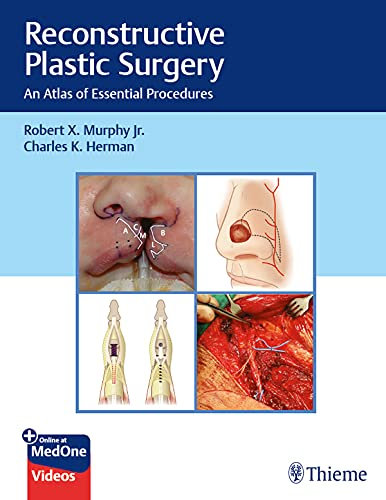 Reconstructive Plastic Surgery: An Atlas of Essential Procedures (English Edition)