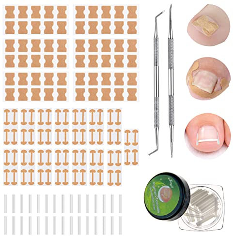 152 Stücke Eingewachsene Zehennägel Werkzeug Set, Zehennagelkorrektur Patch, Gebogen Zehennagel Spange, Eingewachsen Zehennägel Streifen, Zehennagel Feile, Heber, für Eingewachsene Fußnägel