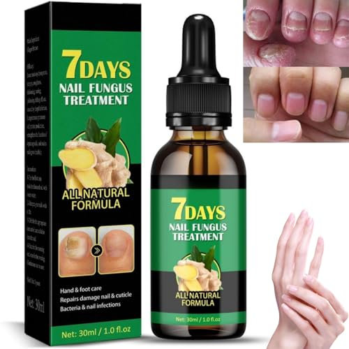 7 Days Ginger Fungal Nail Treatment,Ginger Nail Treatment Nail Support Nail Care,Toe Nail Fungal Treatment,inger Nail Growth Serum,Anti Fungal Treatment Pain Reliever,Nail Repair Treatment