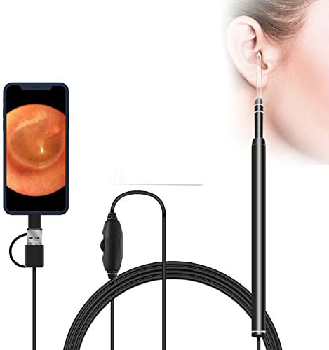 Ohrenschmalz-Entfernungsset Kamera, Digital Led Otoskop Ohr Kamera Scope Ohrenschmalz-Entfernungsset Ohrenschmalz Reinigungswerkzeug
