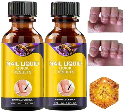 2PCS Bee Venom Fast-Acting Anti-Fungal Nail,Bee Venom Nail Treatment Serum,Bee Venom Nail Fungus Solution,Fungal Nail Treatment and Repair,Fungal Toenail Treatment,Fungal Nail Treatment for Toenails