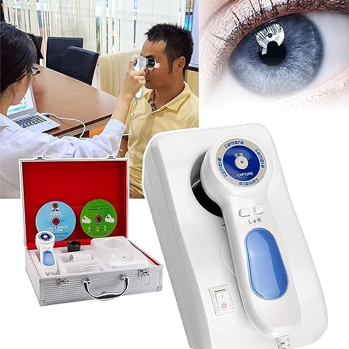 5,0 MP Iridology-kamera med 30 X Iriscope, APP-kontroll, ljusväxling och frysbildbehandling för vetenskaplig ögonanalys på sjukhus och kliniker