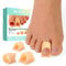Welnove Hammertoe Corrector - 6 Pack Toe Splints - Soft Gel Toe Straighteners - Realign Bent, Curled, Crooked, Claw, Hammer Toes - Toe Corrector for Men and Women, 3 Different Sizes(Beige)
