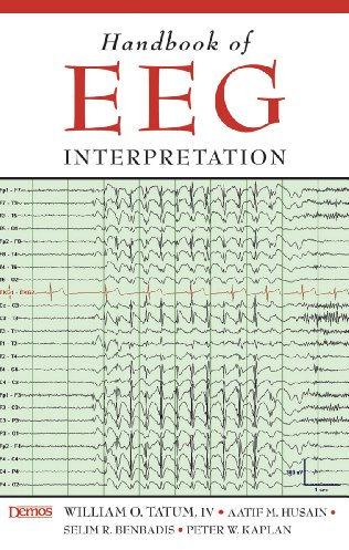 Handbook of EEG Interpretation (English Edition)