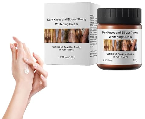 Acanthoglow Therapiecreme, dunkle Knie und Ellbogen, starke Aufhellungscreme, starke dunkle Knöchel, Hautaufhellungscreme, dunkle Flecken-Korrekturcreme für Achselhöhlen, Knie, Ellbogen (1 Stück)