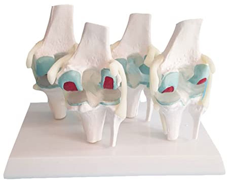 Lebensgroßes Menschliches Modell Für Degenerative Kniegelenkserkrankungen Medizinische Anatomie Mit Basis Für Das Lernen Im Medizinischen Klassenzimmer
