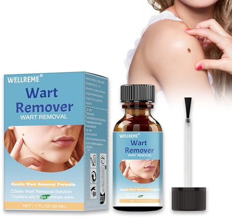 Wart Remover, Skin Care for Wart Removal on Hands and Body, Suitable for Various Skin Types (30ml)